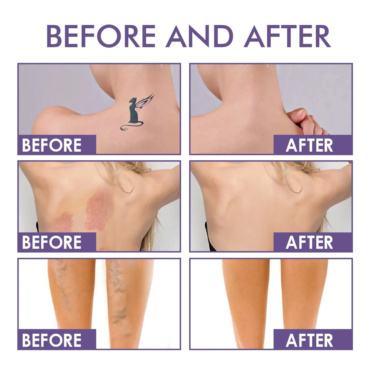 Body Perfector