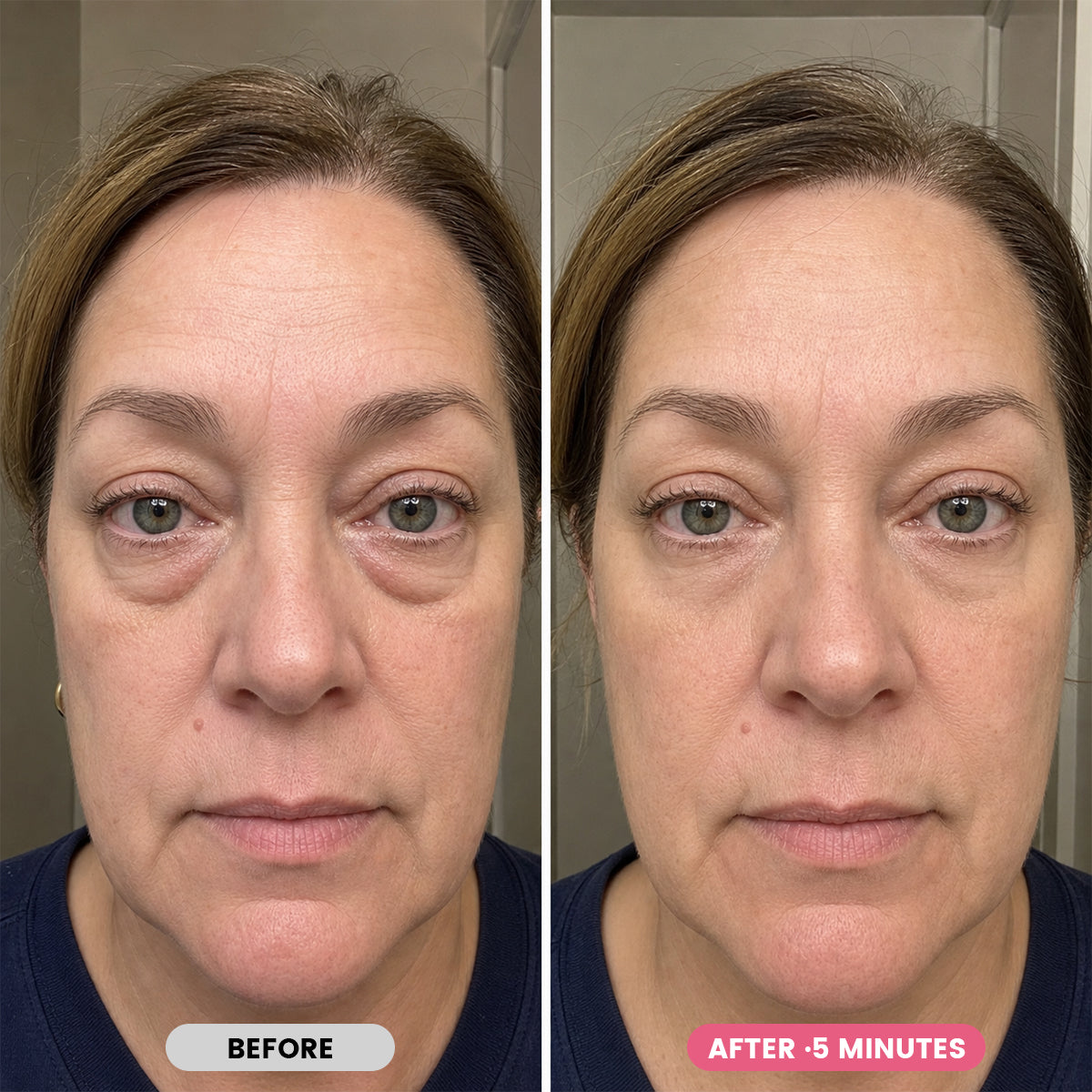 K-Lift™ Instant Lift Serum | PDRN + Peptides — image 4