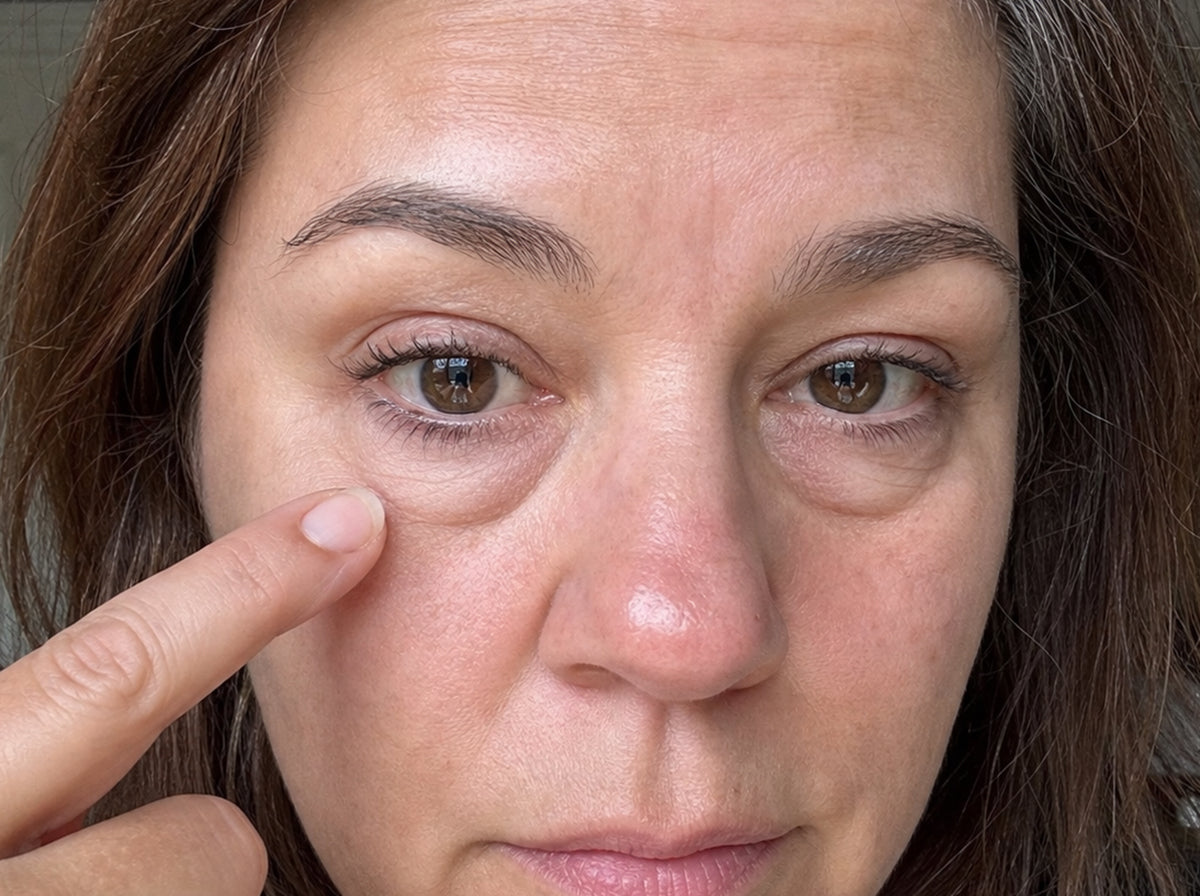 Concealer creasing over an under-eye bag