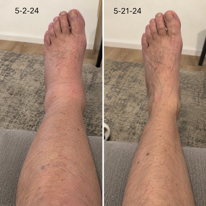 using Tryzovira less than 8 weeks
