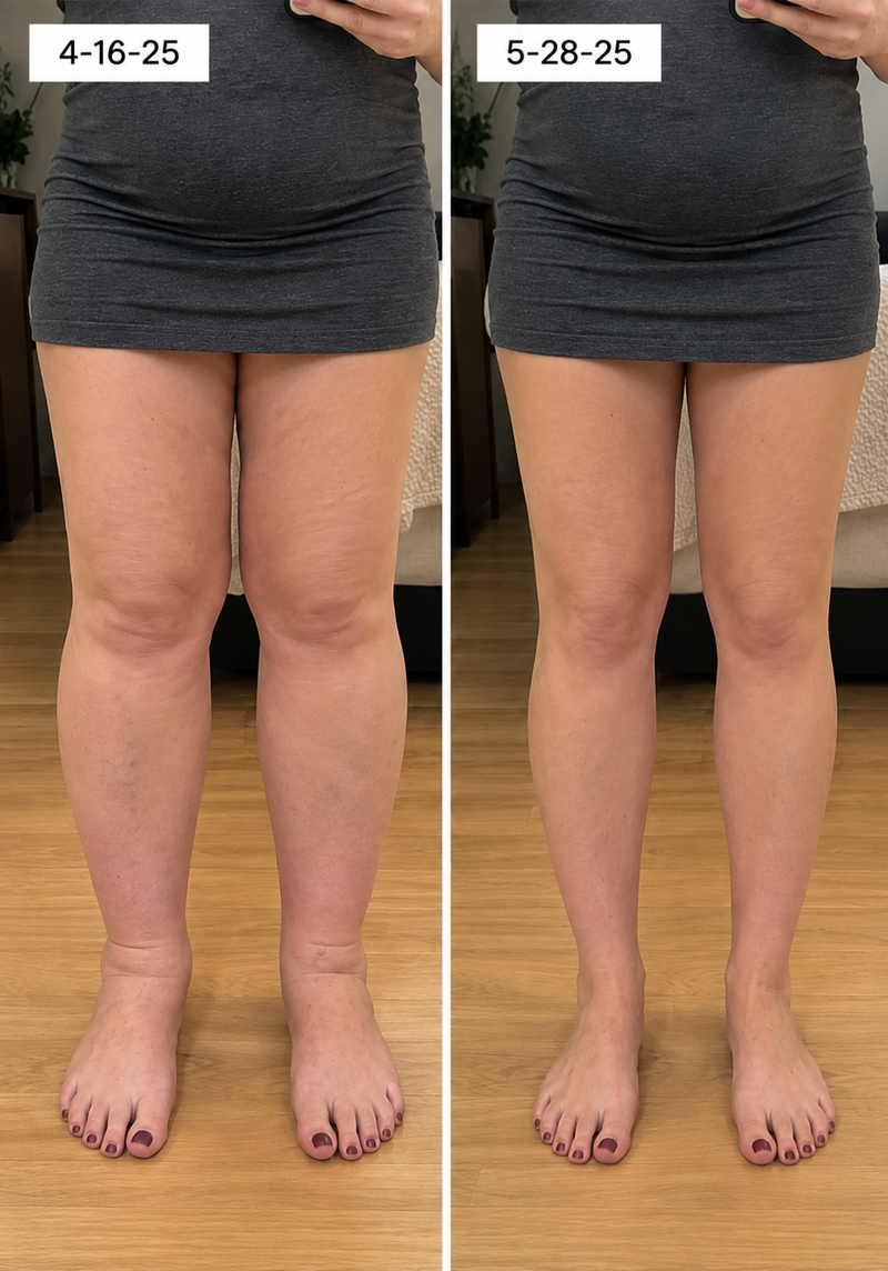 using Tryzovira less than 8 weeks
