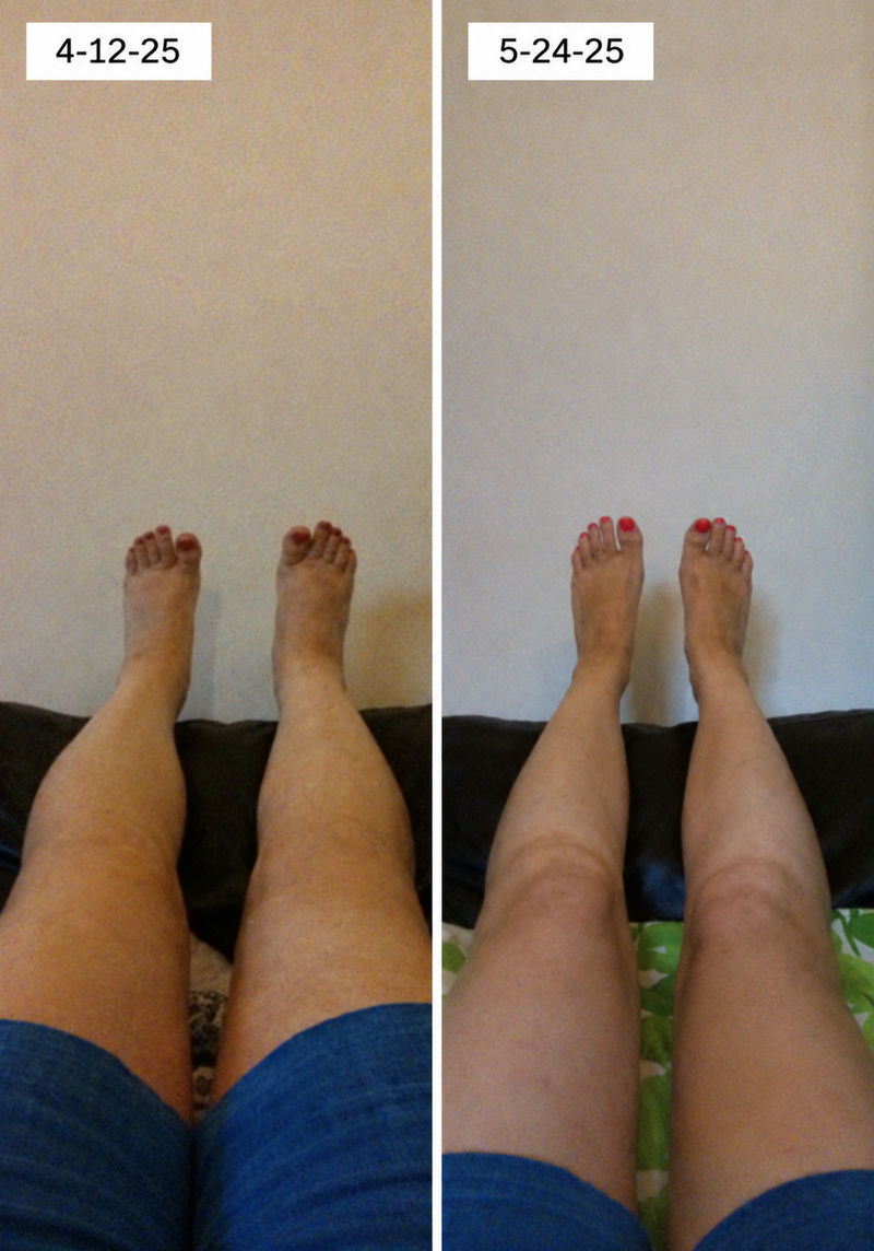 using Tryzovira less than 8 weeks