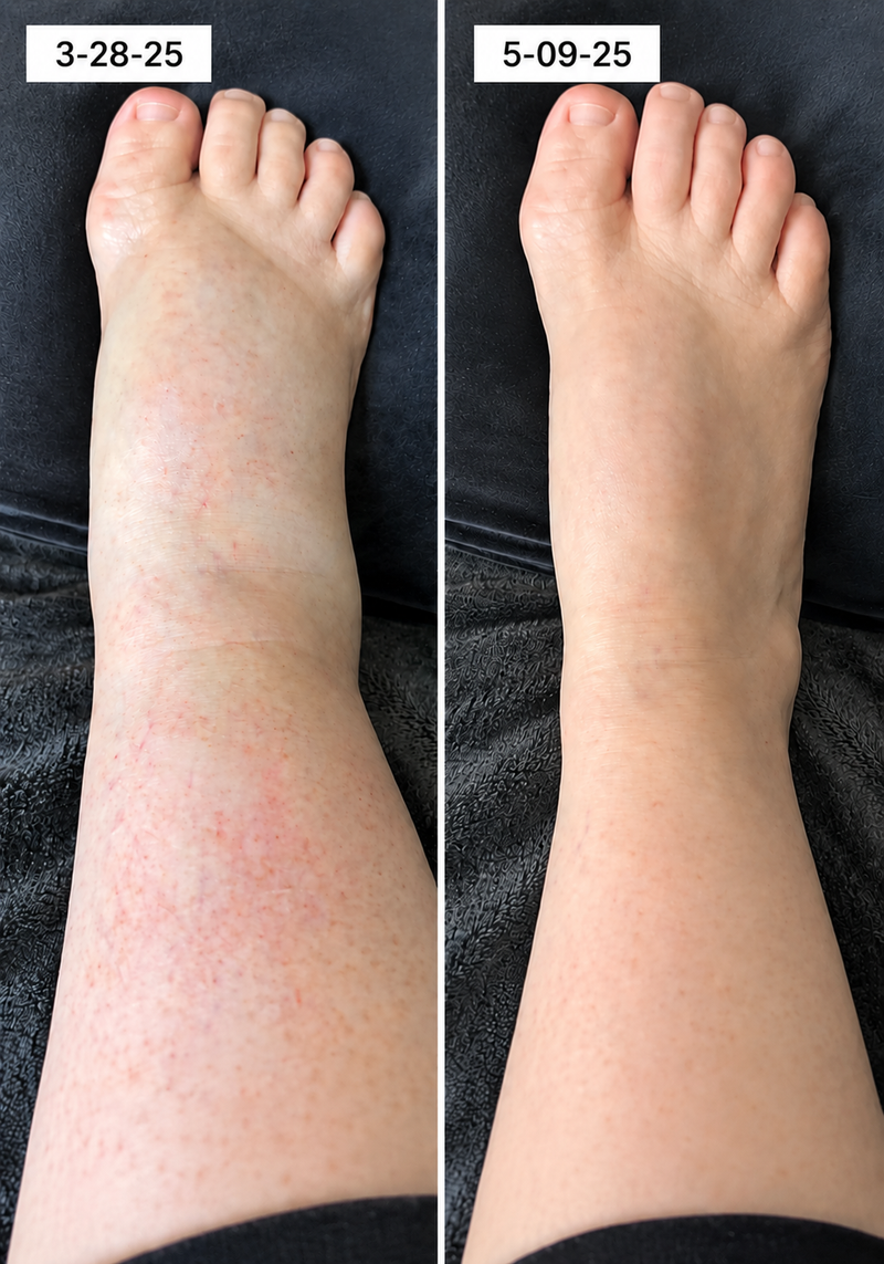 using Tryzovira less than 8 weeks